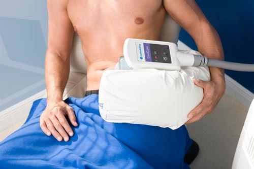 Efficacité de la Cryolipolyse par Coolsculpting