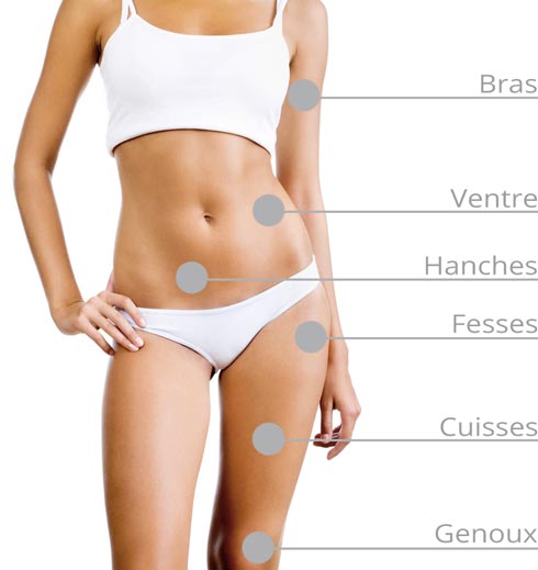 Amincir la silouhette avec la cryolipolyse avec coolsculpting